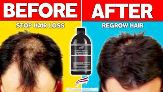 The best shampoo for hair loss and hair regrowth.  The Professional Strength Hair Restore Shampoo