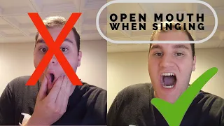 How to Open Your Mouth when Singing: Singing Technique Ep.4
