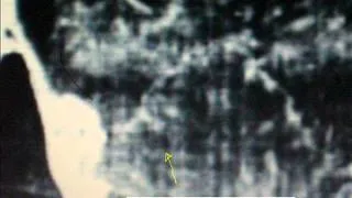 Shroud Of Turin Spear Puncture Hole Revealed Close Up Ruello