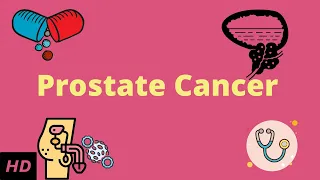 Prostrate Cancer, Causes, Signs and Symptoms, DIagnosis and Treatment.