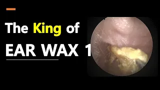 The King of EARWAX 1