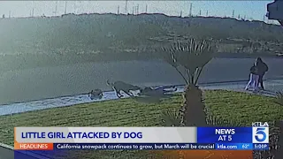 Little girl attacked by dog