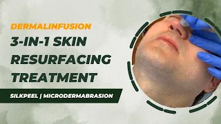 DERMALINFUSION 3-In-1 Skin Resurfacing Treatment | SilkPeel | Microdermabrasion | Dr. Jason Emer