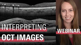 Ordering and Interpreting Retinal OCT Images