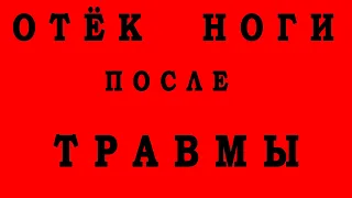 Отек ноги и Боль после Травмы. Тромбоз глубоких вен. Тромбофлебит. Покраснение Воспаление. УЗИ вен.