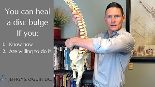 How to heal a disc bulge | Heal your disc naturally