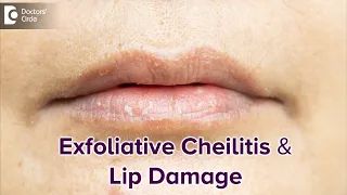 Exfoliative Cheilitis & its effect on Lips | DRY LIPS-Best Treatment-Dr.Rasya Dixit| Doctors' Circle