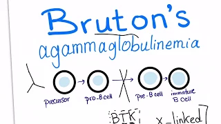 Bruton's agammaglobulinemia (X-linked agammaglobulinemia) with a mnemonic