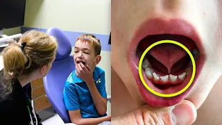 Un Garçon De 6 Ans N'avait Jamais Parlé, Puis Le Dentiste Découvre L'incroyable Raison