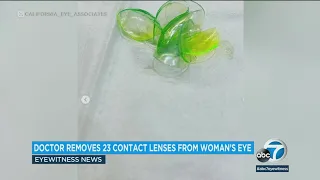 'Like a stack of pancakes': Doctor removes 23 contact lenses from patient's eye