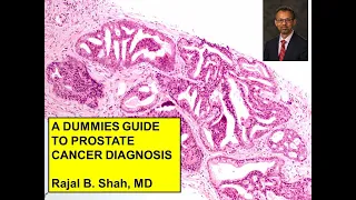 A Dummies Guide to Prostate Cancer Diagnosis