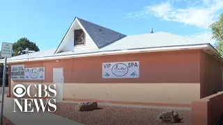 “Vampire facials” at New Mexico spa linked to 2 HIV cases