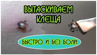 КАК вытащить Клеща у человека БЫСТРО (Klíšť, Ticks, Schildzecken,Кліщ)