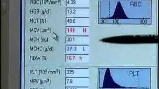 How to Use a Blood Analyser | William Armour