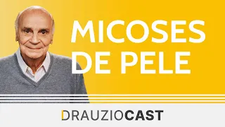 Micoses de pele | DrauzioCast