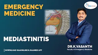 Emergency Medicine | Mediastinitis | Raaonline #emergencymedicine #medicine_knowledge #mediastinitis