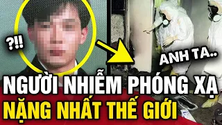 Chàng trai người Nhật 'NHIỄM PHÓNG XẠ' nặng nhất thế giới và 83 ngày ĐỊA NGỤC | Tin 3 Phút