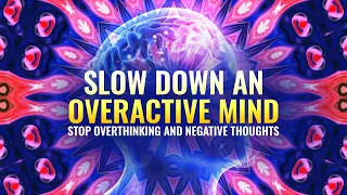 Stop Overthinking: Anxiety Relief Music, Slow Down an Overactive Mind