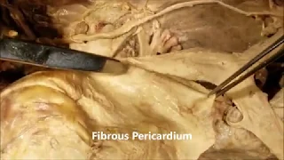 ROOT of NECK MEDIASTINUM Fibrous PERICARDIUM P Sinuses with Clinical Aspects – Sanjoy Sanyal