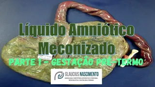 Líquido Amniótico Meconizado - Parte 01