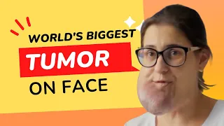 Huge Face Tumor Story #shorts