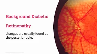 Background Diabetic Retinopathy