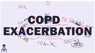 COPD lecture for USMLE and wards (Full)