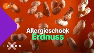 Todesgefahr durch Erdnüsse? Was eine Allergie und allergischer Schock ist  | Terra X plus