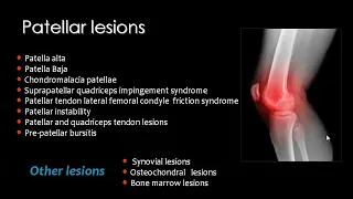 Knee Joint Imaging ( part 3) ..Prof.mamdouh Mahfouz (2019 edition)