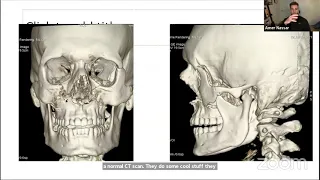 Virtual Shadowing Session 63 - "Specialty Spotlight: Plastic & Reconstructive Surgery"