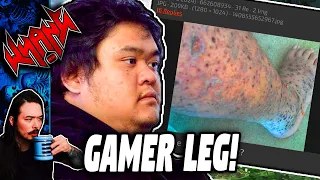 Gamer Leg! - Tales From the Internet