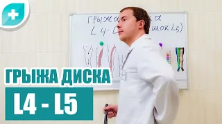 Что такое грыжа межпозвоночного диска L4 - L5