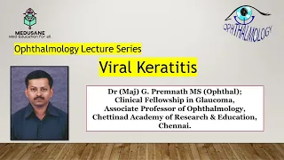 Viral Keratitis | Ophthalmology | Dr (Maj) G. Premnath M.S., | MEDUSANE