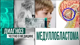 Медуллобластома: чем опасна опухоль головного мозга? | Диагноз