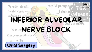 Inferior Alveolar Nerve Block Technique