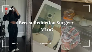 VLOG | Breast Reduction Surgery 🍒✂️