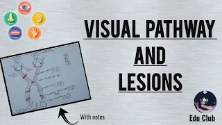 Visual Pathway Physiology and Lesions | Visual Field Defects || Special Senses Physiology