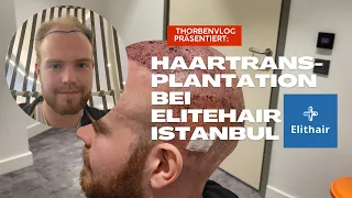 Haartransplantation bei EliteHair Istanbul / Reise Vlog