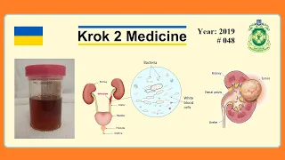 [ Krok 2 Medicine ] Year: 2019 - 048 (Ministry of Public Health of Ukraine)