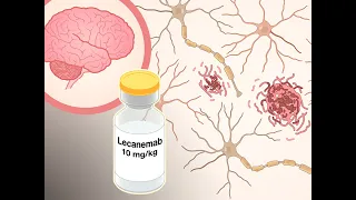 Lecanemab in Alzheimer’s Disease | NEJM