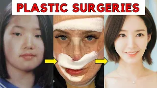 Korean Actors With The MOST Craziest Plastic Surgeries