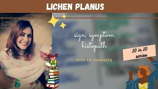lichen planus I dental lectures