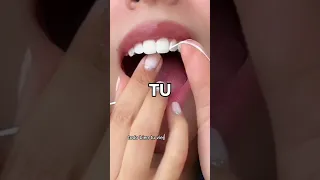 ¿Tienes caries entre los dientes?🙀🦷 ¡mira este video!🫨 #retoshorts30