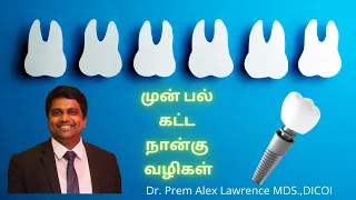 4 options to replace front tooth | முன் பல் கட்ட நான்கு வழிகள் | 4 options to replace a tooth |Tamil