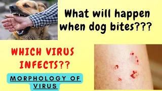 Rabies virus part 1 (Dog bite) Virology/ Microbiology series/ CNS