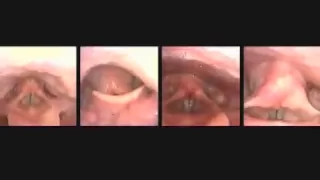 Vocal Cords up close while singing