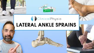 Lateral Ankle Sprains | Expert Explains Mechanism Of Injury and Rehab Plan