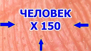 Человек под микроскопом в увеличении 150 крат