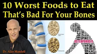 10 Worst Foods to Eat That's Bad for Your Bones (Osteoporosis) - Dr. Alan Mandell, D.C.