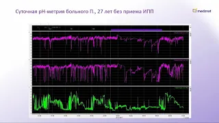 Кайбышева В.О. Ведение пациентов с кислотозависимыми заболеваниями в вопросах и ответах